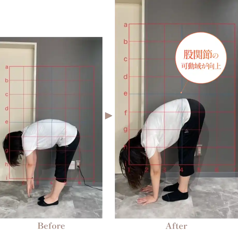 骨盤回りの事例写真